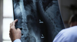 Leia mais sobre o artigo Técnico em Radiologia